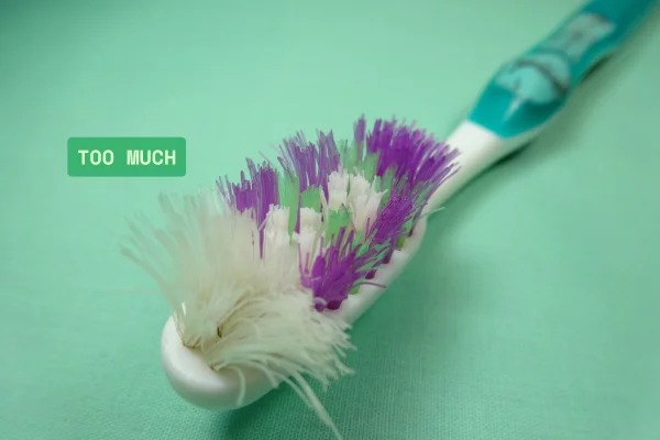 over brushing